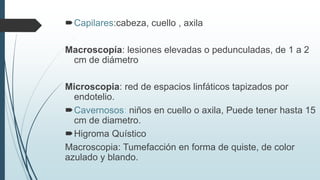 Capilares:cabeza, cuello , axila
Macroscopía: lesiones elevadas o pedunculadas, de 1 a 2
cm de diámetro
Microscopia: red de espacios linfáticos tapizados por
endotelio.
Cavernosos: niños en cuello o axila, Puede tener hasta 15
cm de diametro.
Higroma Quístico
Macroscopia: Tumefacción en forma de quiste, de color
azulado y blando.