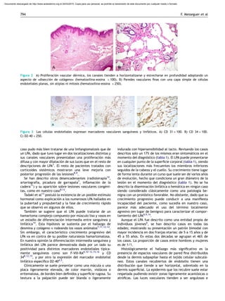 caso pudo ma´s bien tratarse de una linfangiomatosis que de
un LPA, dado que tuvo lugar en dos localizaciones distintas y
sus canales vasculares presentaban una proliferacio´n ma´s
difusa y con mayor dilatacio´n de sus luces que en el resto de
descripciones de LPA7
. El resto de pacientes tratados con
corticoides siste´micos mostraron una leve mejorı´a con
posterior progresio´n de las lesiones8,9
.
Se han descrito otros desencadenantes (radioterapia10
,
arteriografı´a, picadura de garrapata7
, inﬂamacio´n de la
cadera11
) y su aparicio´n sobre lesiones vasculares conge´ni-
tas, como en nuestro caso8,12
.
Tadaki et al13
postulo´ la existencia de un posible estı´mulo
hormonal como explicacio´n a los numerosos LPA hallados en
la pubertad y prepubertad y la fase de crecimiento ra´pido
que se observo´ en algunos de ellos.
Tambie´n se sugiere que el LPA puede tratarse de un
hamartoma complejo compuesto por mu´sculo liso y vasos en
un estadio de diferenciacio´n intermedia entre sanguı´nea y
linfa´tica14
. Esta hipo´tesis se sustenta por el hallazgo de
desmina y cola´geno IV rodeando los vasos ano´malos7,11,12,14
.
Sin embargo, el caracterı´stico crecimiento progresivo del
LPA va en contra de su posible naturaleza hamartomatosa.
En nuestra opinio´n la diferenciacio´n intermedia sanguı´nea y
linfa´tica del LPA parece demostrada dada por un lado su
positividad para distintos marcadores endoteliales tı´pica-
mente sanguı´neos como son F-VIII-RA8,10–12,15,16
y CD
348,12,15
, y por otro la expresio´n del marcador endotelial
linfa´tico especı´ﬁco D2-404,5
.
Clı´nicamente se suele presentar como una ma´cula o una
placa ligeramente elevada, de color marro´n, viola´cea o
eritematosa, de bordes bien deﬁnidos y superﬁcie rugosa. Su
textura a la palpacio´n puede ser blanda o ligeramente
indurada con hipersensibilidad al tacto. Revisando los casos
descritos solo un 17% de los mismos eran sintoma´ticos en el
momento del diagno´stico (tabla 1). El LPA puede presentarse
en cualquier punto de la superﬁcie corporal (tabla 1), siendo
sus localizaciones ma´s frecuentes los miembros inferiores
seguidos de la cabeza y el cuello. Su crecimiento tiene lugar
de forma lenta durante un curso que suele ser de varios an˜os
de evolucio´n, hecho que condiciona un gran dia´metro de la
lesio´n en el momento del diagno´stico (tabla 1). No se ha
descrito la diseminacio´n linfa´tica o hema´tica en ningu´n caso
siendo considerado cla´sicamente como una patologı´a be-
nigna con un prono´stico favorable. No obstante, dado que su
crecimiento progresivo puede conducir a una maniﬁesta
incapacidad del paciente, como sucedı´a en nuestro caso,
parece ma´s adecuado el uso del te´rmino localmente
agresivo (en lugar de benigno) para caracterizar el compor-
tamiento del LPA8,9,14
.
Aunque el LPA fue descrito como una entidad propia de
individuos jo´venes6
, se han descrito casos en todas las
edades; mostrando su presentacio´n un patro´n bimodal con
mayor incidencia en dos franjas etarias: de 5 a 15 an˜os y de
45 a 55 an˜os. En estas dos de´cadas se agrupan el 46% de
los casos. La proporcio´n de casos entre hombres y mujeres
es de 1/1.
Histolo´gicamente el hallazgo ma´s signiﬁcativo es la
presencia de espacios vasculares de pared ﬁna distribuidos
desde la dermis subpapilar hasta el tejido celular subcuta´-
neo. Estos canales recubiertos de endotelio tienen una
distribucio´n que tiende a ser horizontal, sobretodo en la
dermis superﬁcial. La epidermis que los recubre suele estar
respetada pudiendo existir zonas ligeramente acanto´sicas o
atro´ﬁcas. Las luces vasculares tienden a ser angulosas e
Figura 2 A) Proliferacio´n vascular de´rmica, los canales tienden a horizontalizarse y estrecharse en profundidad adoptando un
aspecto de )diseccio´n de cola´geno* (hematoxilina-eosina Â 100). B) Paredes vasculares ﬁnas con una capa simple de ce´lulas
endoteliales planas, sin atipias ni mitosis (hematoxilina-eosina Â 250).
Figura 3 Las ce´lulas endoteliales expresan marcadores vasculares sanguı´neos y linfa´ticos. A) CD 31 Â 100. B) CD 34 Â 100.
C) D2-40 Â 250.
F. Messeguer et al794
Documento descargado de http://www.actasdermo.org el 04/03/2015. Copia para uso personal, se prohíbe la transmisión de este documento por cualquier medio o formato.
 
