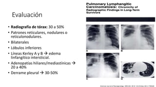 Linfangitis Reticular LINFANGITIS.pptx