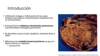 Linfangitis Reticular LINFANGITIS.pptx
