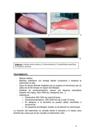 8
3 4
5
TRATAMIENTO
- Reposo relativo.
- Medidas antiedema con vendaje blando compresivo y mantener la
extremidad en alto.
- Agua de Burow (fórmula magistral que se prepara en farmacias) que se
aplica de 20-30 minutos en región de linfangitis.
- profilaxis de tromboembolismo venoso con heparina subcutánea
(clexane sbc mg/kg, hibor 3500 sbc, fraxiparina sbc…).
- Antibióticos:
o Cloxaciclina 500-1000 mg cada 6-8 horas.
o Amoxicilina/clavulánico 500-1000/125 mg 2 cada 12 horas.
o En alérgicos a la penicilina se pueden utilizar macrólidos o
vancomicina.
o En sospecha de linfangitis nodular es de elección el cotrimoxazol.
La duración del tratamiento es variable desde 6 semanas a 6 meses, pero
también hay casos que se han resuelto en tratamiento corto.
Imágenes:1. Herpes zostercutáneo;2. EritemaNudoso;3. Tromboflebitissuperficial;
4. Erisipela;5.Celulitis.
 