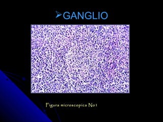 GANGLIO




Figura microscopica No1
 