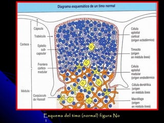 Esquema del timo (normal) figura No
1
 