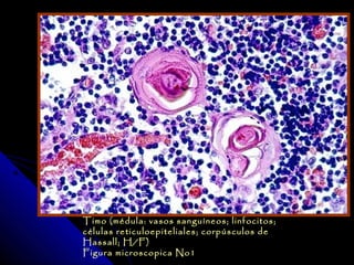 Timo (médula: vasos sanguíneos; linfocitos;
células reticuloepiteliales; corpúsculos de
H assall; H/F)
Figura microscopica No1
 