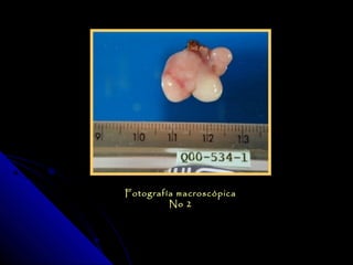 Fotografía macroscópica
         No 2
 