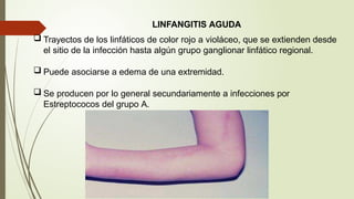Linfangitis Reticular SEMIOLOGIA linfático y bazo EXPLORACION | PPTX