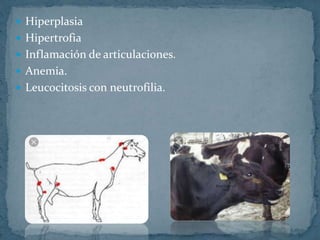  Hiperplasia
Hipertrofia
Inflamación de articulaciones.
Anemia.
Leucocitosis con neutrofilia.