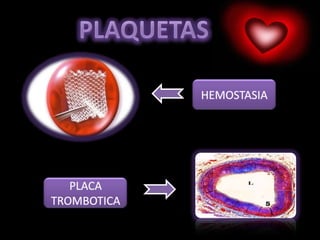 PLAQUETASHEMOSTASIAPLACA TROMBOTICA