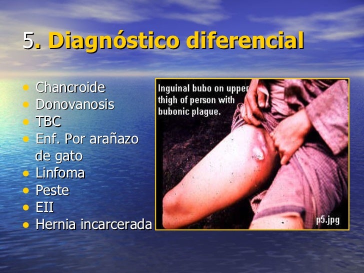Linfogranuloma venereo y Donovanosis