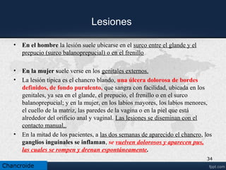 • Chancro en boca. Sexo oral
34
Chancroide
 