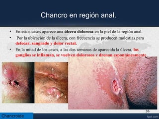 Examen de laboratorio
– Frotis + Gram/Giemsa
•– Cultivo en 2 – 4 horas
– Histología
• Zona necrótica superficial
• Zona de neovascularización
• Infiltrado denso compuesto por linfocitos y
Plasmáticas
– Serología: no útil (descarta sífilis)
– PCR .
Chancroide
 