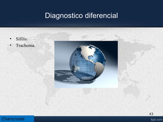 Linfogranuloma venereo