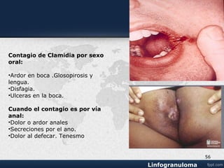 Linfogranuloma venereo
