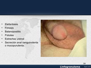 Linfogranuloma venereo