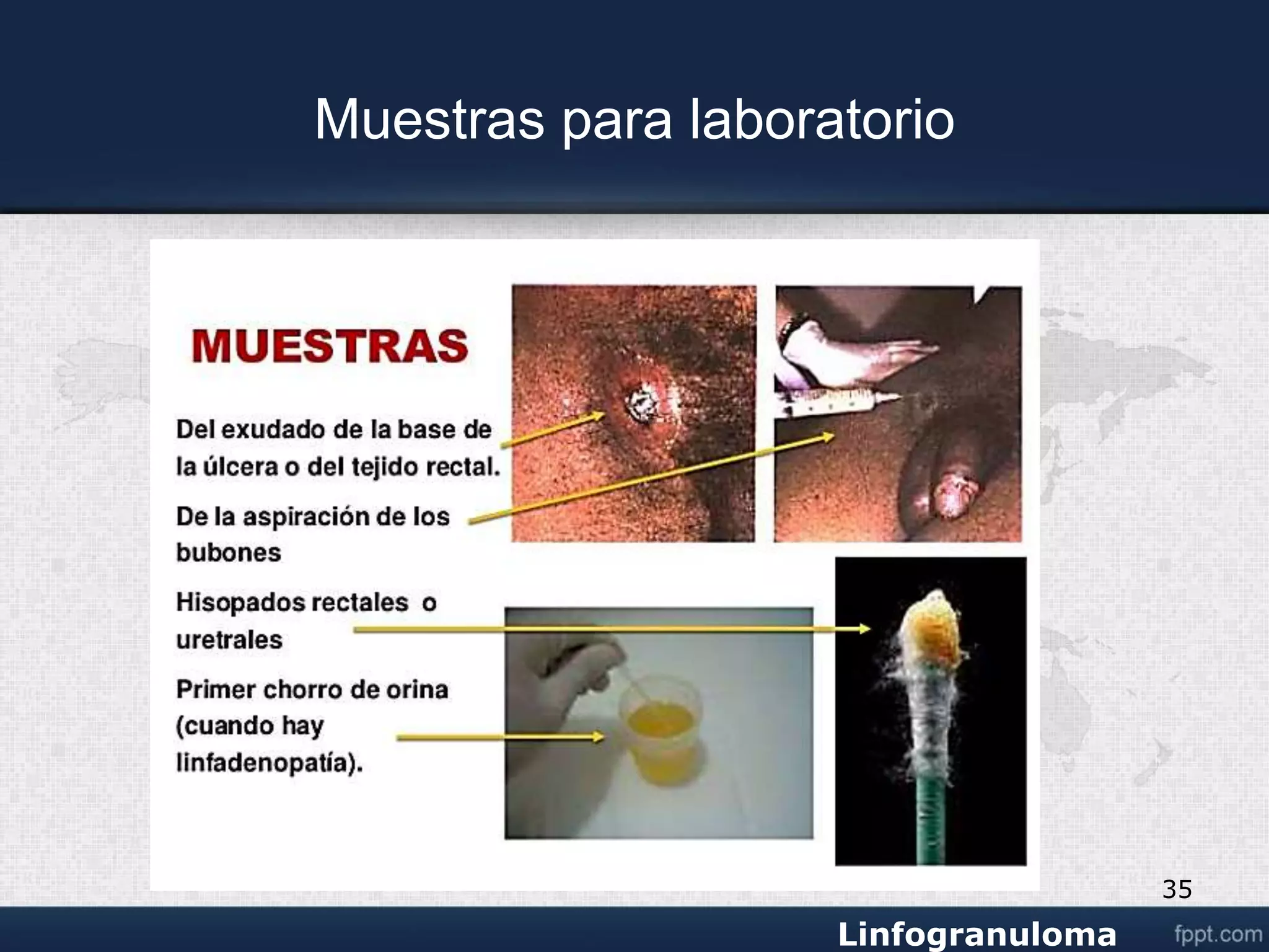 Venereo linfogranuloma venereo.ppt