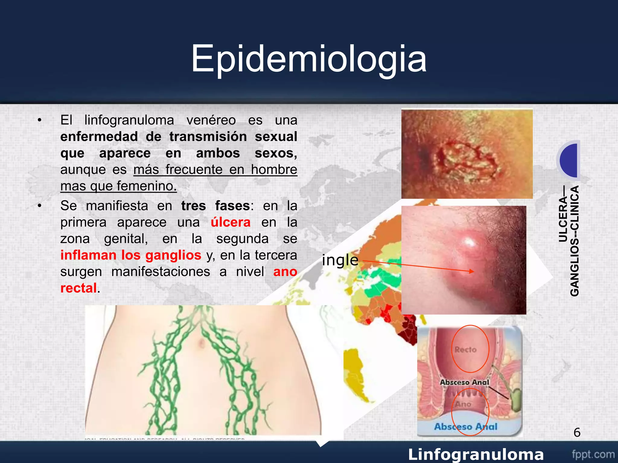 Venereo linfogranuloma venereo.ppt