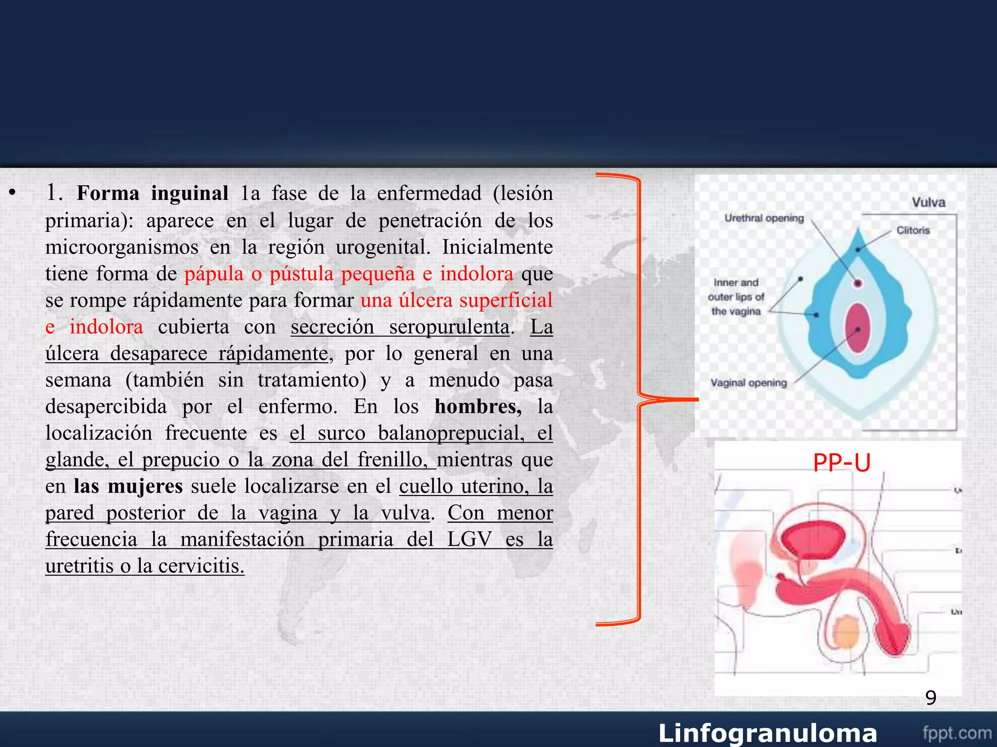 Venereo linfogranuloma venereo.ppt