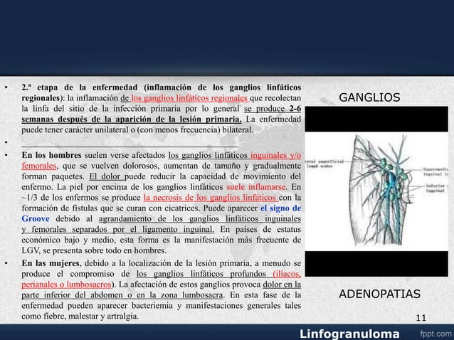 Venereo linfogranuloma venereo.ppt