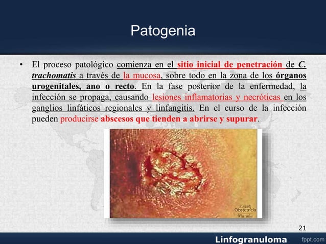 Linfogranuloma Venereoppt 