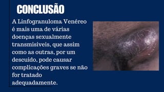 Venereo linfogranuloma venereo (2). infecção sexualmente transmissÃvel | PDF