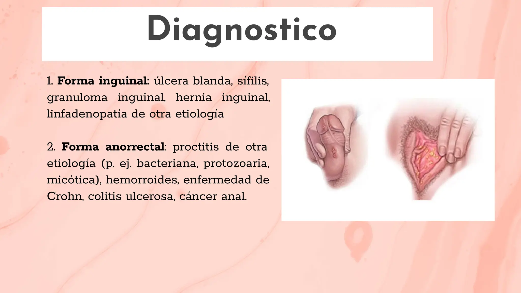 Venereo Linfogranuloma venéreo , patologia dermatologica | PDF