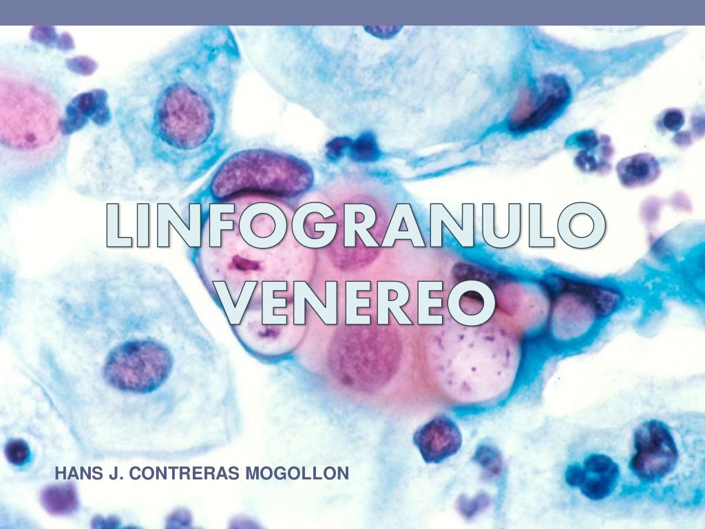 Linfogranuloma venéreo