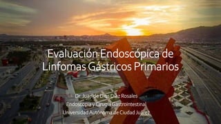 Evaluación Endoscópica de
LinfomasGástricos Primarios
Dr. Juan de Dios Díaz Rosales
Endoscopia yCirugíaGastrointestinal
UniversidadAutónoma deCiudad Juárez
 