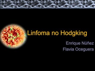 Enrique Núñez
Flavia Oceguera
Linfoma no Hodgking
 