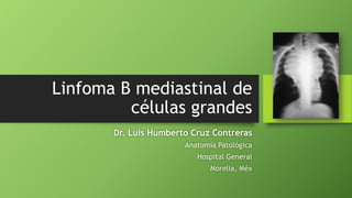 Linfoma B mediastinal de
células grandes
Dr. Luis Humberto Cruz Contreras
Anatomía Patológica
Hospital General
Morelia, Méx
 