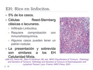 EH: Rico en linfocitos.



5% de los casos.
Células
Reed-Sternberg
clásicas o lacunares.







Infiltrado Linfociti...