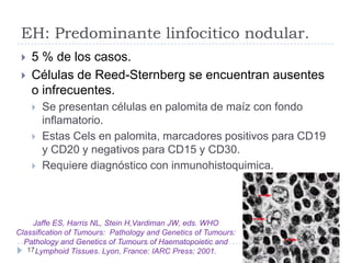 EH: Predominante linfocitico nodular.



5 % de los casos.
Células de Reed-Sternberg se encuentran ausentes
o infrecuent...