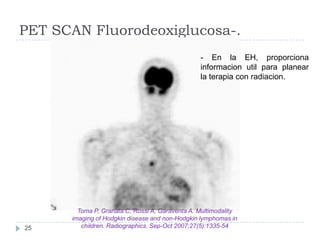 PET SCAN Fluorodeoxiglucosa-.
- En la EH, proporciona
informacion util para planear
la terapia con radiacion.

25

Toma P,...