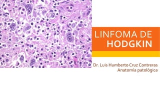 LINFOMA DE
HODGKIN
Dr. Luis Humberto Cruz Contreras
Anatomía patológica

 