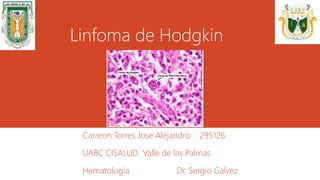 Linfoma de Hodgkin 
Carreon Torres Jose Alejandro 295126 
UABC CISALUD Valle de las Palmas 
Hematologia Dr. Sergio Galvez 
 