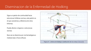 Diseminacion de la Enfermedad de Hodking 
Sigue un patrón de continuidad hacia 
estructuras linfáticas vecinas, este patrón es 
el que caracteriza y diferencia de otros 
linfomas. 
Puede afectar a órganos o estructuras 
vecinas. 
Rara vez se disemina por vía hematógena a 
medula ósea o focos difusos 
 