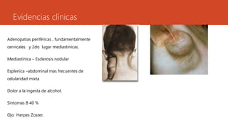Evidencias clínicas 
Adenopatias periféricas , fundamentalmente 
cervicales y 2do lugar mediastinicas. 
Mediastinica – Esclerosis nodular 
Esplenica –abdominal mas frecuentes de 
celularidad mixta 
Dolor a la ingesta de alcohol. 
Sintomas B 40 % 
Ojo Herpes Zoster. 
 