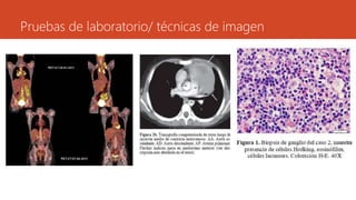 Pruebas de laboratorio/ técnicas de imagen 
 