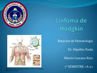 Rotación de Hematología 
Dr. Hipólito Paula 
Martin Lescano Ruiz 
7° SEMESTRE «A-2» 
http://www.cancer.gov/espanol/pdq/tratamiento/hodgkina 
dultos/Patient/page1 
 