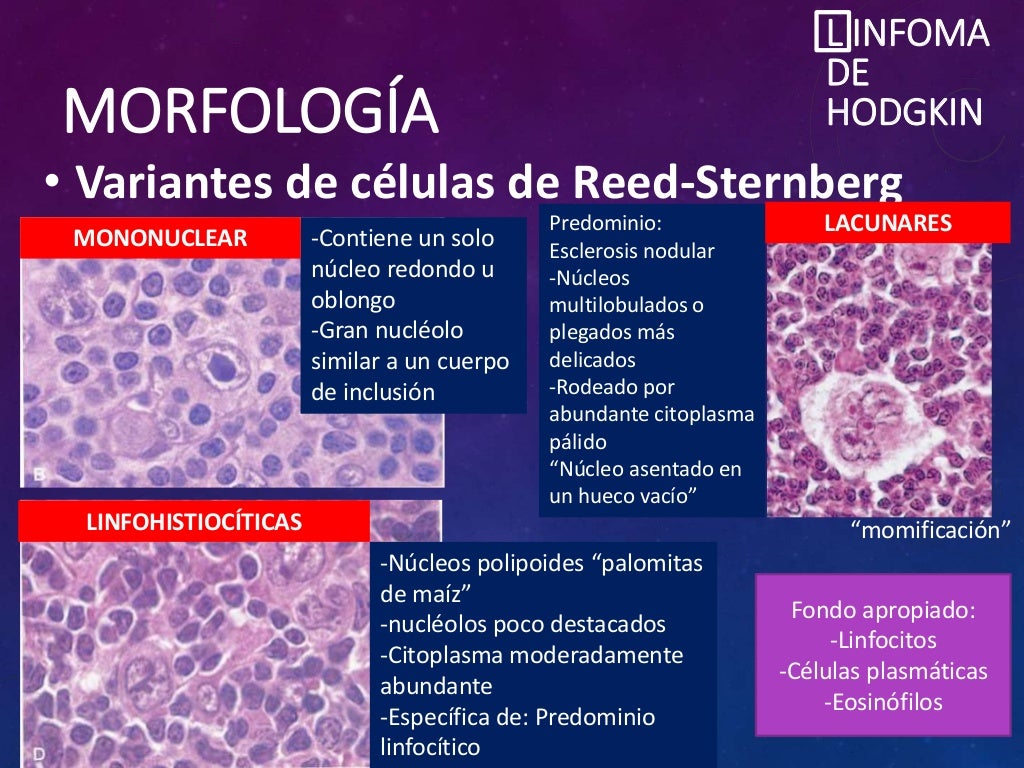 Linfoma de Hodgkin Linfoma de Hodgkin