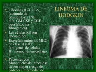 • Citocinas IL-4, IL-5       LINFOMA DE
  (acúmulo de
  eosinófilos), TNF           HODGKIN
  alfa, GM-CSF y TGF-
  beta (citocina
  fibrogénica).
• Las células RS son
  aneuploides.
• Expresan antígenos MHC
  de clase II y B7.
  (antígenos de células
  B), monocitos/macrófago
  s.
• Pacientes con
  Mononucleosis infecciosa
  tienen mayor riesgo de
  padecer Enfermedad de
 