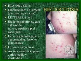 • HLA-DR y CD1a.
• Granulaciones de Birbeck      HISTIOCITOSIS
    (cuerpos raquetoides).
•   LETTERER-SIWE:
•   Erupción seborreica, cara
    anterior de
    tronco, espalda y piel
    cabelluda.
•   Hepatoesplenomegalia, a
    denomegalias, lesiones
    pulmonares.
•   Lesiones osteolíticas.
•   Anemia, trombocitopenia
    , otitis media y
    mastoiditis.
 