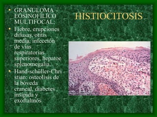 • GRANULOMA
  EOSINOFÍLICO
  MULTIFOCAL:
                         HISTIOCITOSIS
• Fiebre, erupciones
  difusas, otitis
  media, infección
  de vías
  respiratorias
  superiores, hepatoe
  splenomegalia.
• Hand-schüller-Chri
  stian: osteolisis de
  la bóveda
  craneal, diabetes
  insípida y
  exoftalmos
 