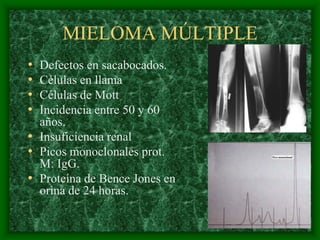 MIELOMA MÚLTIPLE
• Defectos en sacabocados.
• Células en llama
• Células de Mott
• Incidencia entre 50 y 60
  años.
• Insuficiencia renal
• Picos monoclonales prot.
  M: IgG.
• Proteína de Bence Jones en
  orina de 24 horas.
 