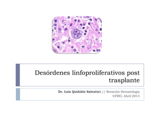 Desórdenes linfoproliferativos post
trasplante
Dr. Luis Quiñiñir Salvatici // Rotación Hematología
UFRO, Abril 2013
 