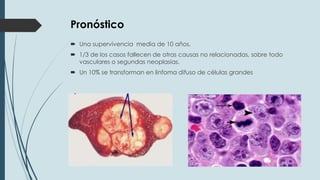 Pronóstico
 Una supervivencia media de 10 años.
 1/3 de los casos fallecen de otras causas no relacionadas, sobre todo
vasculares o segundas neoplasias.
 Un 10% se transforman en linfoma difuso de células grandes

 