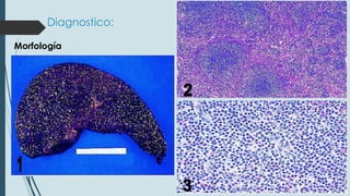 Diagnostico:
Morfología

 
