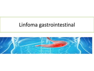 Linfoma gastrointestinal
 