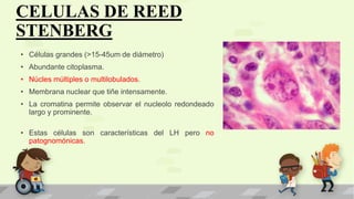 CELULAS DE REED
STENBERG
• Células grandes (>15-45um de diámetro)
• Abundante citoplasma.
• Núcles múltiples o multilobulados.
• Membrana nuclear que tiñe intensamente.
• La cromatina permite observar el nucleolo redondeado
largo y prominente.
• Estas células son características del LH pero no
patognomónicas.
 