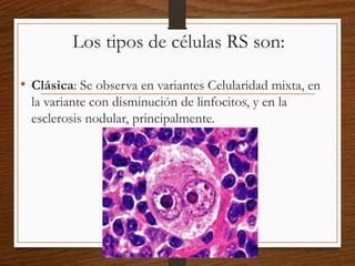 Los tipos de células RS son:
• Clásica: Se observa en variantes Celularidad mixta, en
la variante con disminución de linfocitos, y en la
esclerosis nodular, principalmente.
 