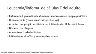 Leucemia/linfoma de células T del adulto
• Enfermedad generalizada afecciones medula ósea y sangre periférica
• Hipercalcemia (con o sin afecciones huesos)
• Arquitectura ganglio sustituida por infiltrado de células de linfoma
• Núcleos con pliegues
• Aumento actividad mitótica
• Infiltrados eosinofilos y células plasmáticas
Shirlyn B. Mckenzie. Hematologia clínica. 2da edición. Manual moderno
 